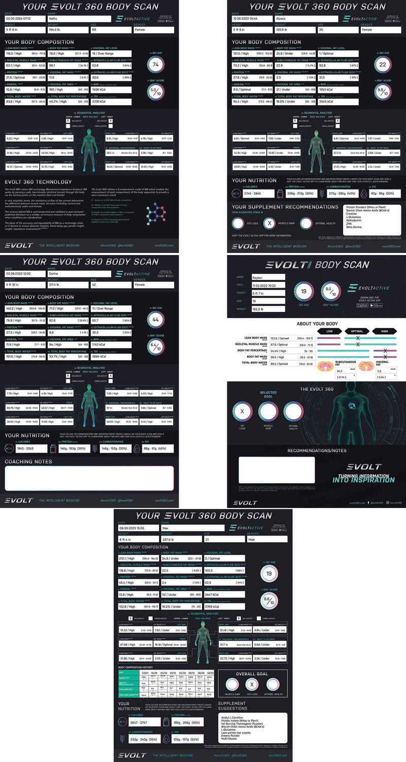 Load image into Gallery viewer, Evolt 360 Body Scanner