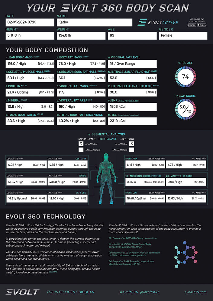 Load image into Gallery viewer, Evolt 360 Body Scanner